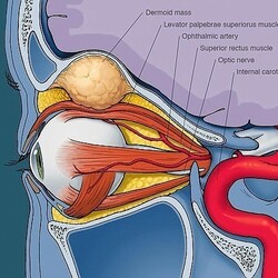 Идеальное ЗРЕНИЕ: гимнастика БЕЙТСА Как... | Интересный контент в группе Целебник. Журнал здорового образа жизни (ЗОЖ).