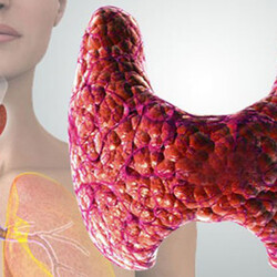 Каκ вылeчить щитовидную железу травами