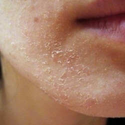 Когда организм просит о помощи