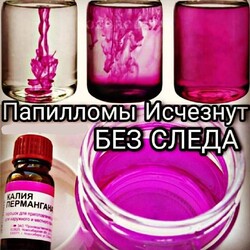 Удаление папиллом в домашних условиях