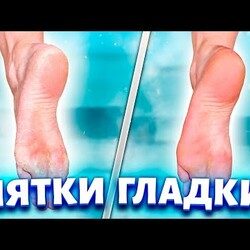 У меня пятки всегда как у "младенца". Пятиминутный способ, который уберет натоптыши и сухие мозоли.