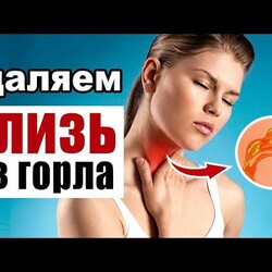 Эффективные способы избавления от слизи в горле в домашних условиях