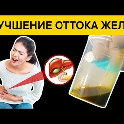 Последствия ЗАСТОЯ ЖЕЛЧИ. Продукты для улучшения ОТТОКА ЖЕЛЧИ