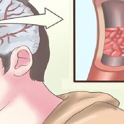 10 продуктов старательно очистят артерии: в целях профилактики инфаркта. Еда вместо лекарств! - womenres.ru