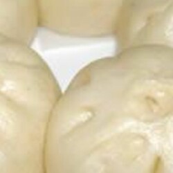 Простой Рецепт как Приготовить Чара Сиу Бао — китайских паровых булочек с начинкой из свинины — Советы, Ингредиенты и Пошаговое Приготовление с Фото