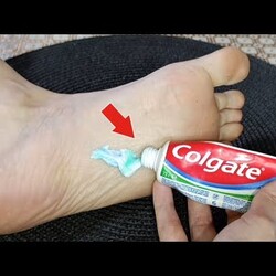 НАМАЗАЛА Зубную Пасту на Ноги и ПЕРЕСТАЛА ТРАТИТЬ ДЕНЬГИ В МАГАЗИНЕ  #совет