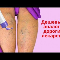 Дешевые аналоги дорогих лекарств: мази от варикоза и тромбофлебита. Обзор недорогих мазей.