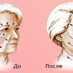 избавиться от морщин!