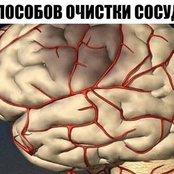 5 СПОСОБОВ ОЧИСТКИ СОСУДОВ ГОЛОВНОГО МОЗГА 