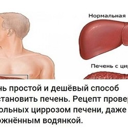 Очищение печени в домашних условиях