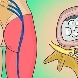 от болей в пояснице! Приструнить седалищный нерв.