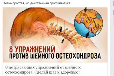 Шейный остеохондроз 