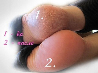 ДЛЯ ВАШИХ ПЯТОЧЕК