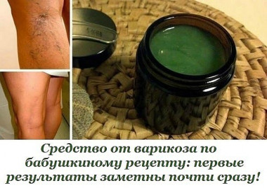 Средство от варикоза по бабушкиному рецепту: первые результаты заметны почти сразу!