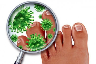 ВЫЛЕЧИЛО ГРИБОК на ногах